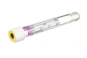 VACUETTE® Zkumavka 5 ml K2EDTA + gel