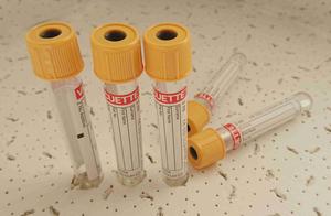 VACUETTE® Zkumavka 3 ml bez přísad, červený štítek