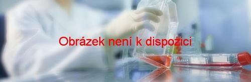 Zkumavka odběr. citrát 0,4 ml